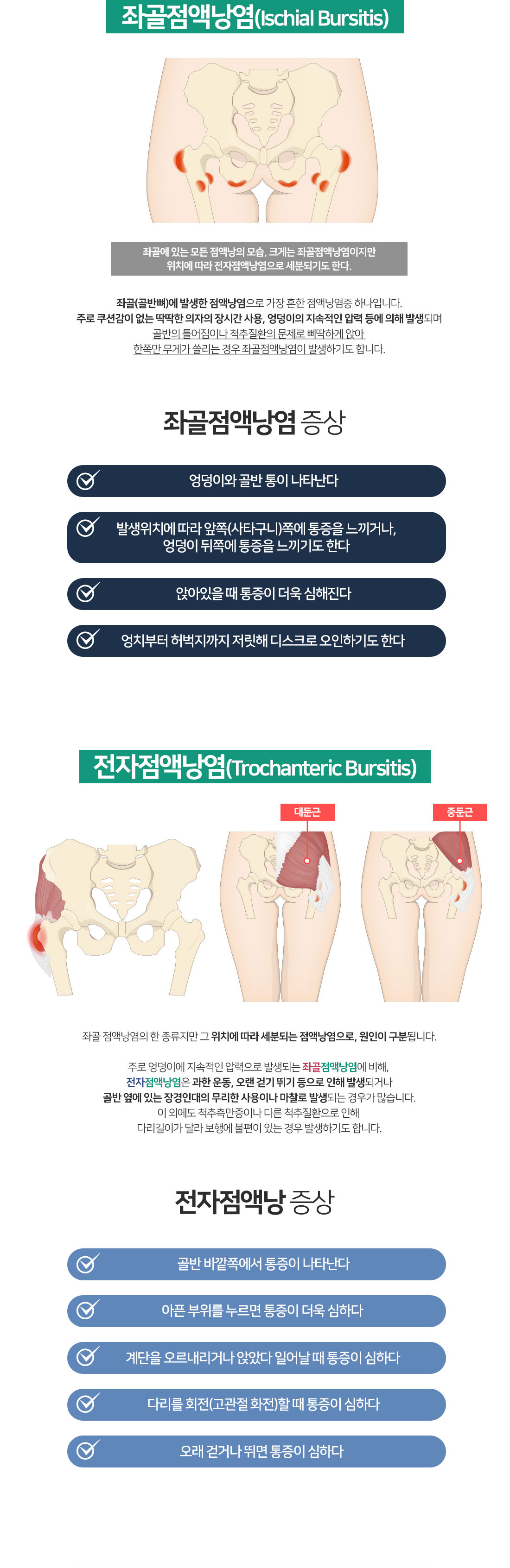 좌골점액낭염-고관절