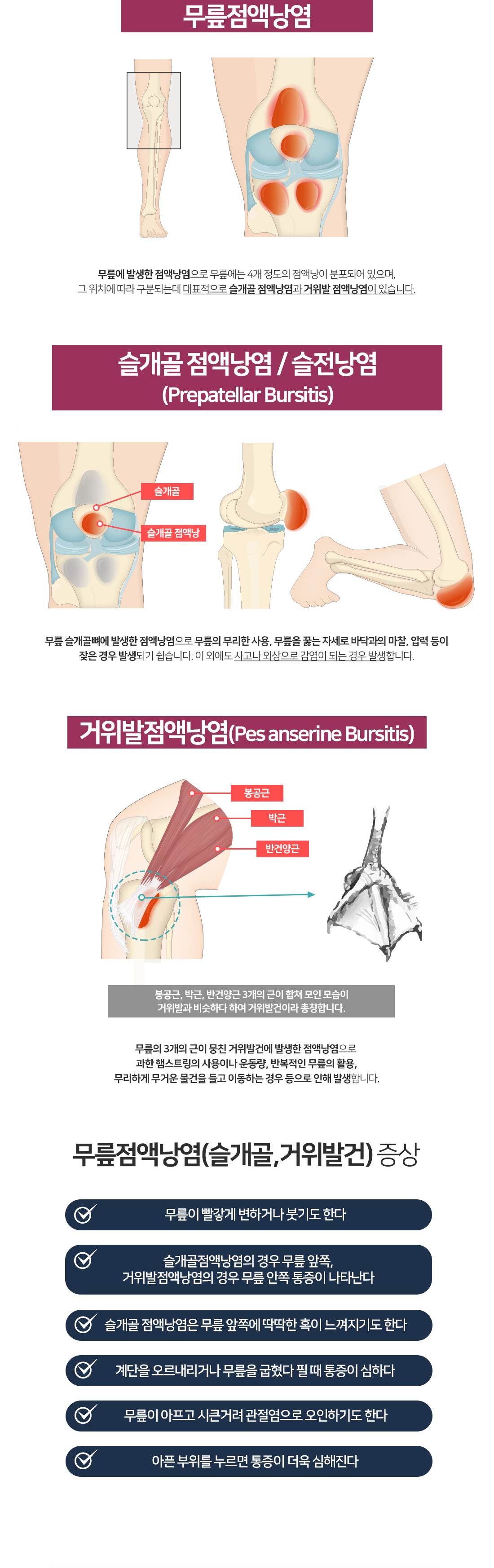 슬개골점액낭염-무릎